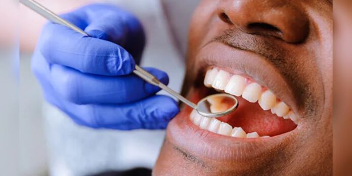 Teeth Cleaning Tips: गुटखा-तंबाकू खाने से दांत हो गए हैं खराब, तो किचन में मौजूद 3 चीजों से बनाए मोतियों जैसे चमकदार